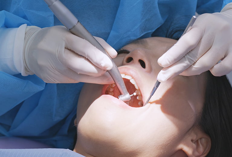 伊勢原の歯医者 越光歯科医院は1本の歯で見るのではなく1口腔で考える治療